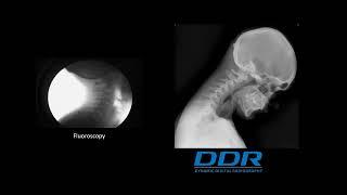 X-Ray That Moves | DDR Orthopedic Applications | Konica Minolta Healthcare
