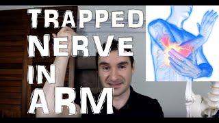 Trapped Nerve In Arm From Pronator Teres Syndrome Info