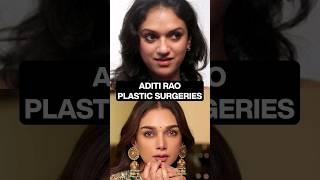 Let's Decode what Plastic Surgeries Aditi Rao hydari has undergone.