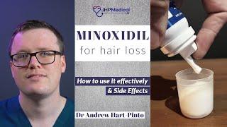 MINOXIDIL treatment for HAIR LOSS |  How and When to use | What Patients Need to Know