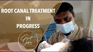 Root Canal Treatment in Progress | RCT | Best Dental Clinic in Kolkata | Best Dentist in Kolkata