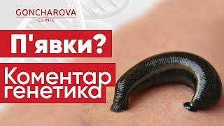 Регулярні п’явки набувають популярності в українців