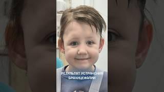 Прекрасный результат - ни следа от брахицефалии!