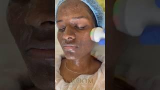 Hydrafacial treatment ️