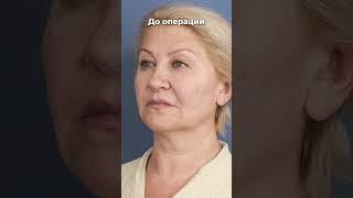 Подробнее об акции на омоложение лица у меня в телеграм: dr_gretskova Евгения Грецкова