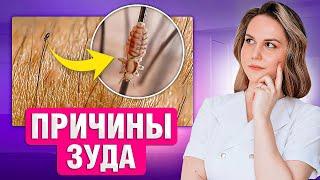 Вагинальный ЗУД, жжение и раздражение. НЕ ИГНОРИРУЙ эти признаки!