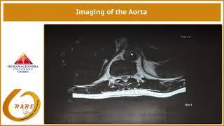 Imaging of the Aorta