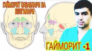 ГАЙМОРИТ БУ НИМА?? БЕЛГИЛАРИ ВА ДАВОЛАШ ЮЛЛАРИ!!!