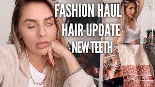 VLOG - New Teeth, Fashion / Beauty Haul & A Hair Update | Fashion Influx