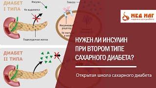 Нужен ли инсулин при втором типе сахарного диабета?