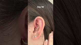 Healing Journey Daith Piercing #daith #daithpiercing #piercing #piercings #herstel