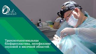 Трансконъюктивальная блефаропластика | Тропешко Владимир Викторович - пластический хирург