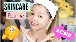 Skincare Routine For Acne Skin  Skincare Routine For Acne Prone Skin  TrinhPham