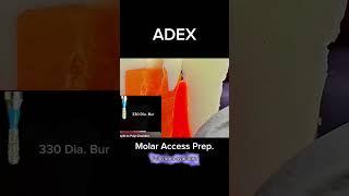 [ADEX] Endo_Posterior Access Prep #drsung #dentist #ADEX #ADEXENDO