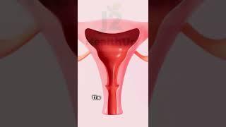 How to Balance Hormones Naturally | PCOS Management Tips #j2healthup #support
