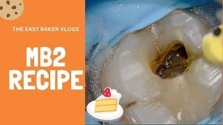 Maxillary Molar Root Canal - The Hunt for MB2