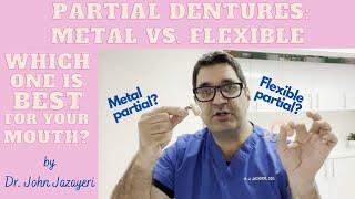 Metal Partial vs. Flexible Partial: Which Do You Choose?