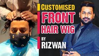 Hair patch, clipping, tapping, bonding, fixing, at hairwig.in by Rizwan 9044459199, 8979775051