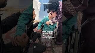 Palestinian girl cries after losing her leg to Israeli attack on Rafah, Gaza