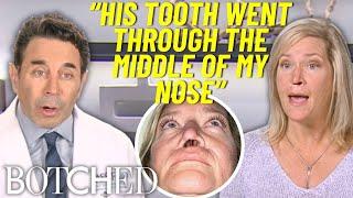 Laura's Dog RIPPED A Giant Hole In Her Nose | Botched | E!