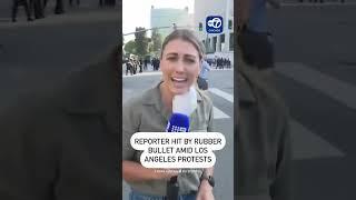 Australian Reporter Hit by Rubber Bullet While Covering Protests in Los Angeles