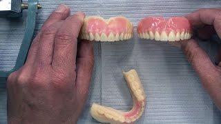 Case of the week: Highlighting the CAD/CAM Denture Process