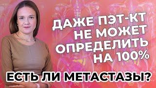 Даже ПЭТ-КТ не может определить на 100%, есть ли метастазы?