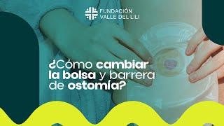 ¿Cómo cambiar la bolsa y barrera de Ostomía?