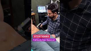 Full Body Laser Hair Reduction | Laser Hair Removal | Hair Reduction #viral #shorts #hair #skincare