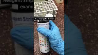 Routine urinalysis test  #shorts #microbiology