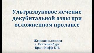 Ультразвуковое  лечение декубитальной язвы при осложненном пролапсе