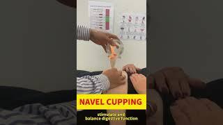 Belly Button Cupping: Restoring Digestive Balance Restore balance to your digestive system with Bell