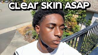 how to get clear skin for guys asap