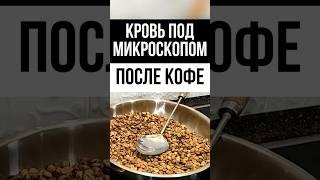  Влияние кофе на бактерии в крови. Эксперимент по микроскопом