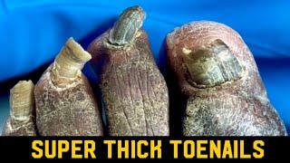 SUPER THICK & SATISFYING NAIL TRIMMING ** ASMR