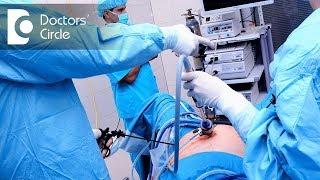 What is the advantage of Laparoscopy Surgery? - Dr. Nupur Sood