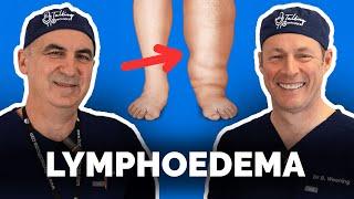 The Truth About Lymphoedema: Causes, Symptoms, and Real Solutions