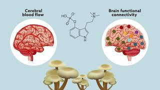 Psilocybin may ‘reset’ the brain to help manage treatment-resistant depression