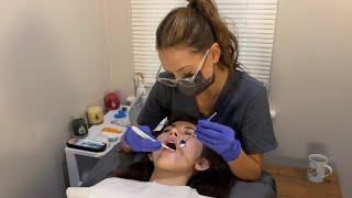 ASMR | Full Relaxing Dental Exam, Cleaning, Fluoride | Real Person | Realistic | Role Play | w/ Zoe