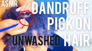 ASMR DANDRUFF HAIR CHECK | ASMR COMBING OUT DANDRUFF