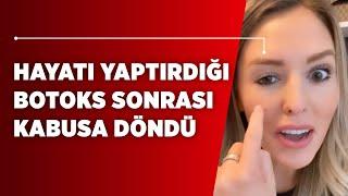 Hayatı Yaptığı Botoks Sonrası Kabusa Döndü