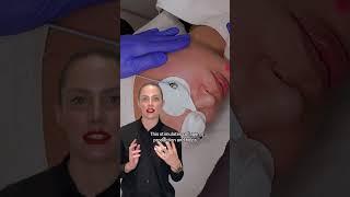 Laser Genesis Skin Treatment for Skin Redness and Rosacea