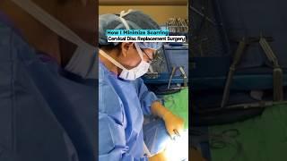 Minimize Scarring in Cervical Disc Replacement Surgery