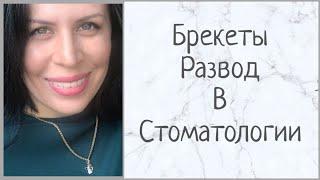 Брекеты, мой опыт | Развод в стоматологии | олесягес