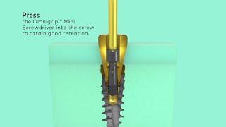 How to remove Nobel Biocare N1 abutments