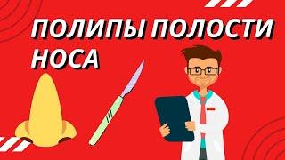 Полипы в носу. Лечение. Причины.Симптомы