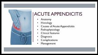 Acute appendicitis