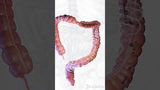  Understanding Diarrhea: Causes and Care   #anatomy #meded #3danimation