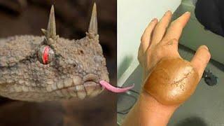 20 Most Painful Snake Bites In The World