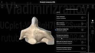 Атлант и осевой позвонок.  Наш Пирогов.  2022 09 12 11 20 10